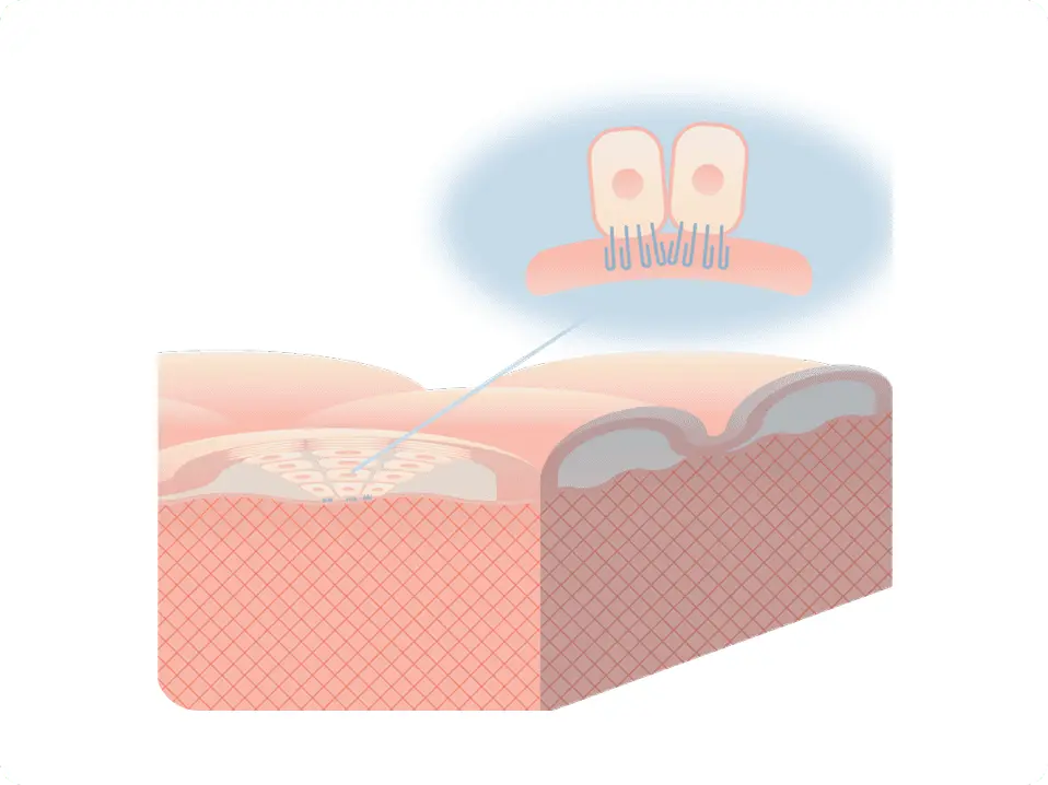 Collagen XVII